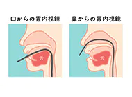 胃カメラは鼻と口からお選びいただけます